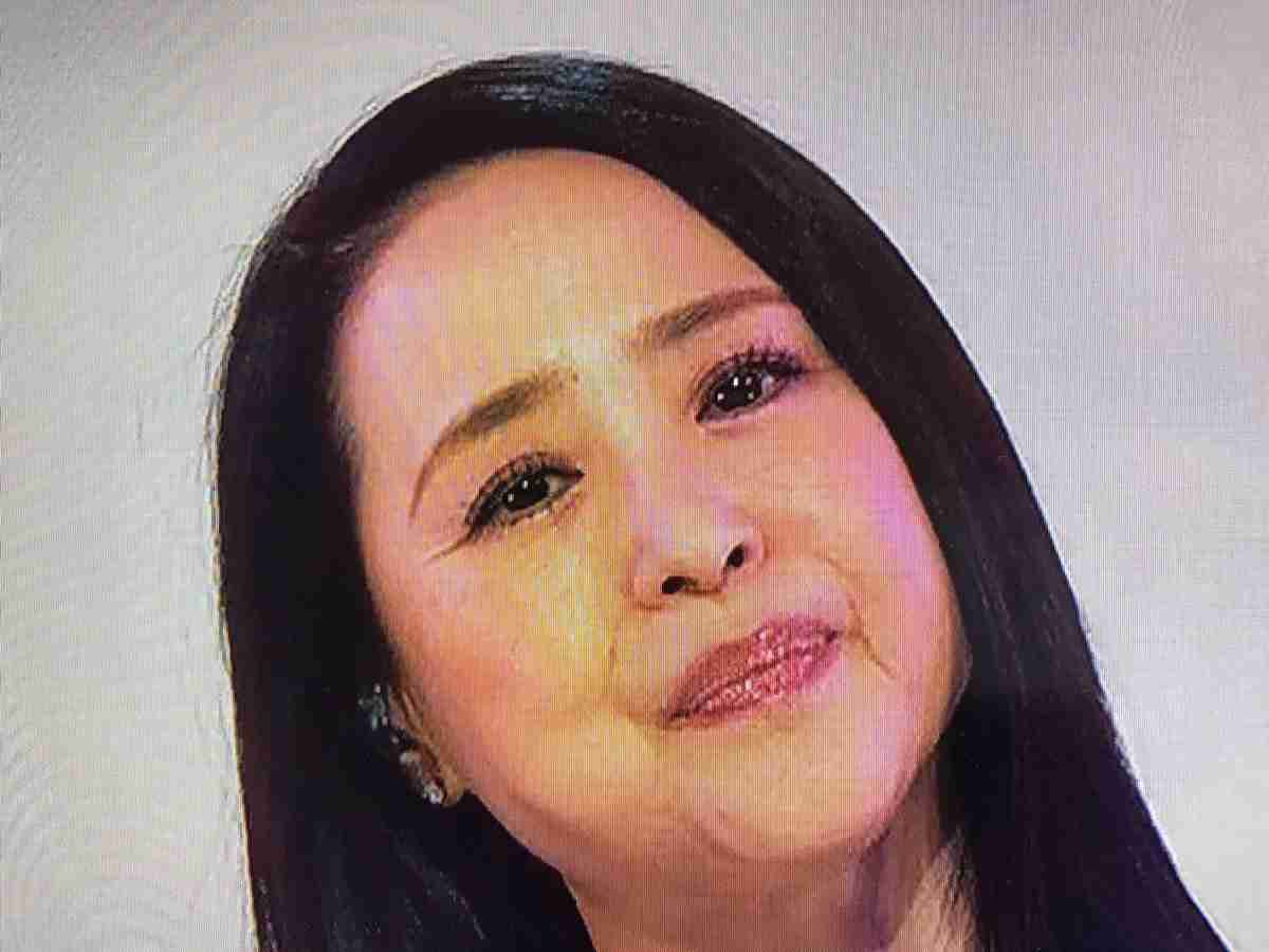 マドンナの顔が激変　膨らみすぎた唇にファン騒然