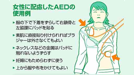 女性が倒れた！　ＡＥＤ使用、ためらうかも…服を脱がせない方法も | ヨミドクター(読売新聞)