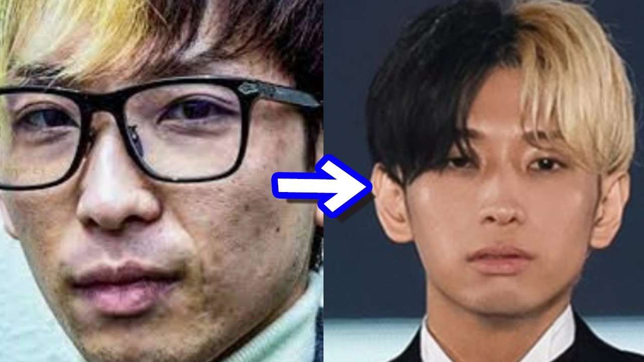 【完全公開】汚すぎた肌はなぜここまで綺麗になったのか？（アトピー乾燥肌ニキビ跡がほぼ完治） - YouTube