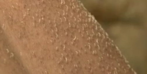 【閲覧注意】集合体好きな人パート4