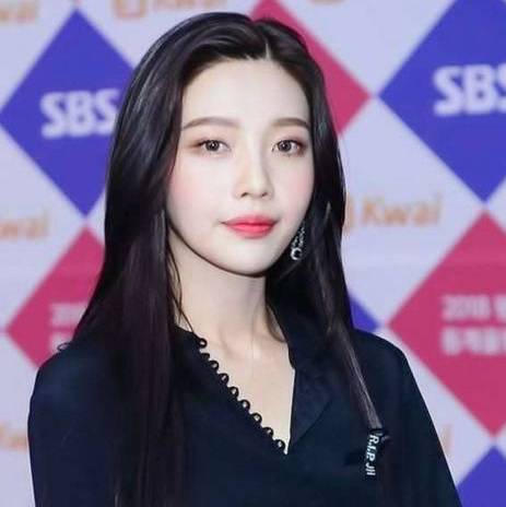 ヘアライン矯正をして垢抜けた韓国芸能人まとめ - 韓国トレンド情報・韓国まとめ　JOAH-ジョア-