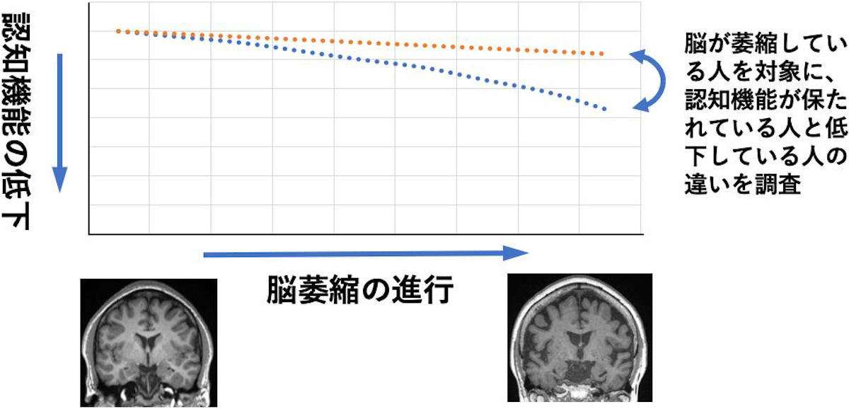 脳が萎縮しても認知機能を維持できる人の特徴は何か？、京大が調査（マイナビニュース） - Yahoo!ニュース