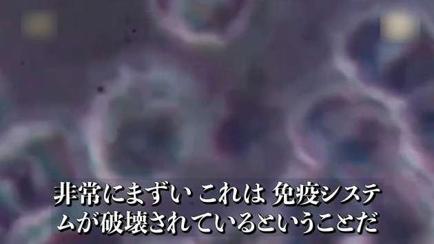 報告は氷山の一角！コロナワクチン接種後の副反応、死亡のツイートが多すぎて戦慄！vol.275 | 泣いて生まれてきたけれど