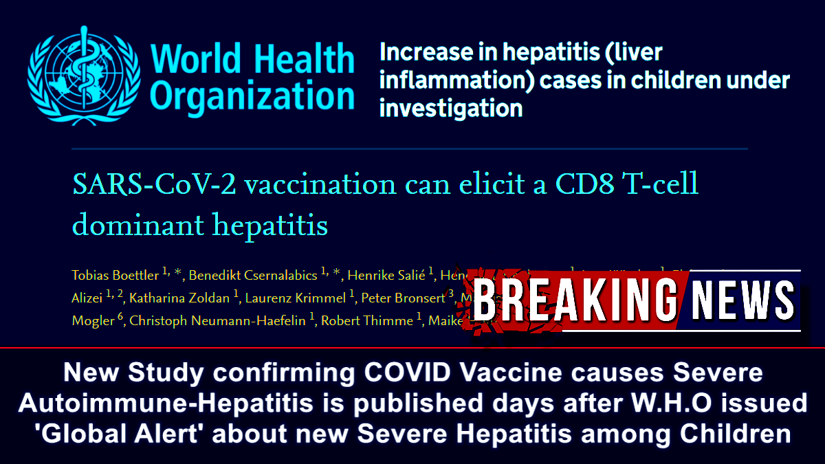 New Study confirming COVID Vaccine causes Severe Autoimmune-Hepatitis is published days after W.H.O issued ‘Global Alert’ about new Severe Hepatitis among Children – The Expose