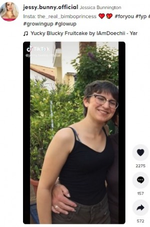 900万円超の整形でセクシーさを追求した21歳女性、家族に縁を切られるも「整形は続ける」(オーストリア)