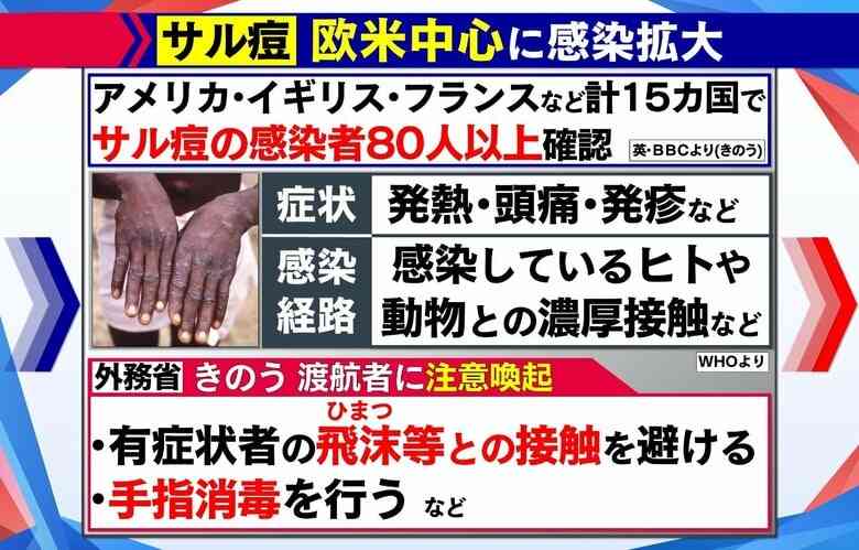 “マスク生活”で免疫力は?「ウイルスに過剰反応」も…サル痘・小児肝炎 新たな感染症広がり