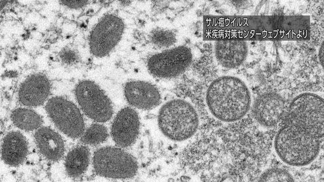サル痘「国内での感染確認されず 天然痘ワクチン備蓄」厚労相 | NHK | 医療