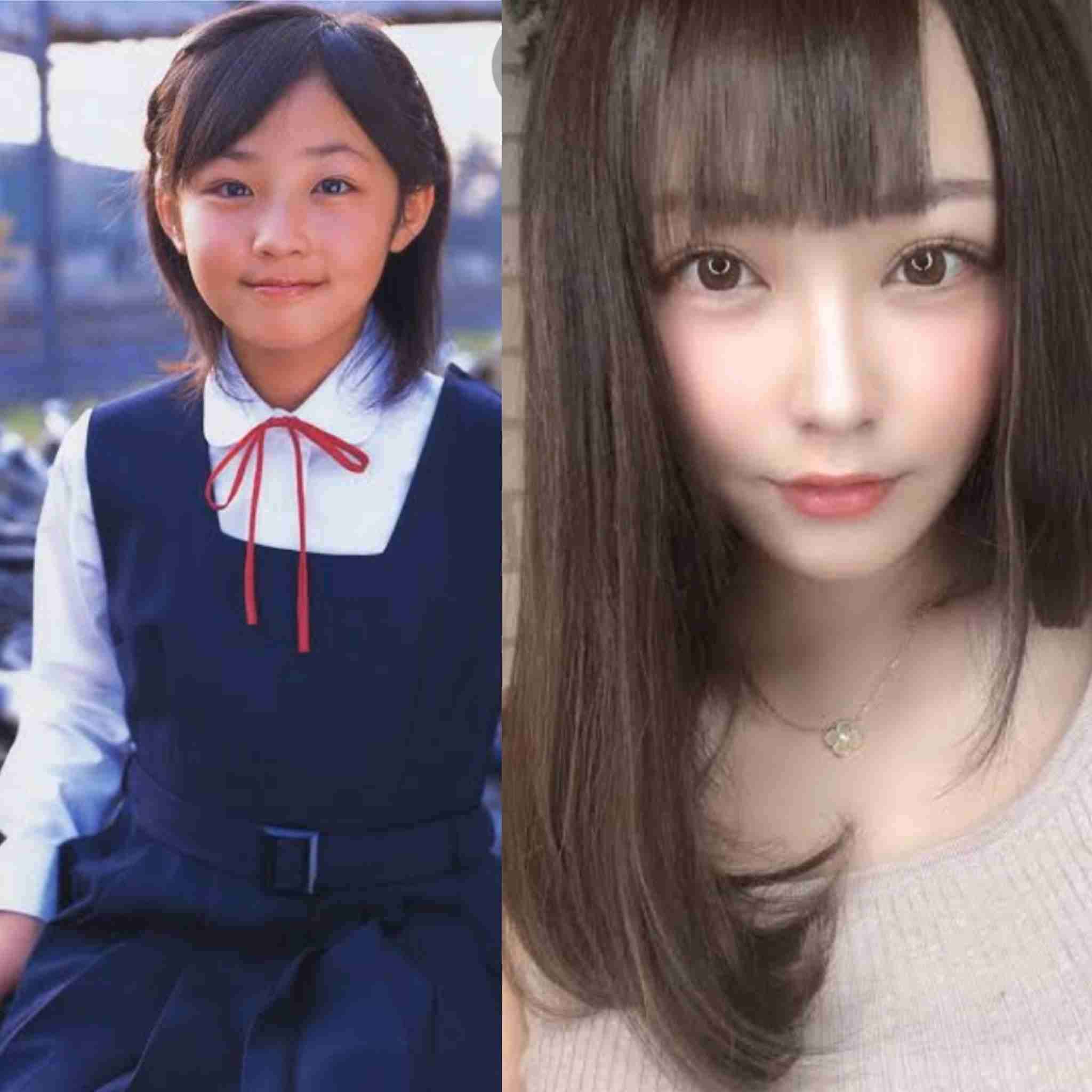 てんちむ、元カレが美形すぎて悩んだ過去「隣に並ぶのがコンプレックスで…だから整形した！」