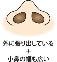 鼻の穴が大きい