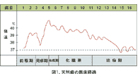天然痘（痘そう）とは