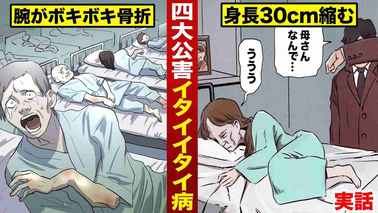 【実話】イタイイタイ病...全ての骨が折れる。身長が縮んで死ぬ。 - YouTube