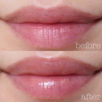 唇の日焼け対策に！紫外線をカットする「リップクリーム」10選 - @cosmeまとめ（アットコスメまとめ）