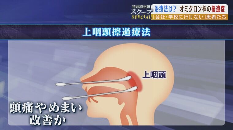 「一度寝ると17時間は起きられない」急増する『オミクロン株の後遺症患者たち』訴えるのは強い