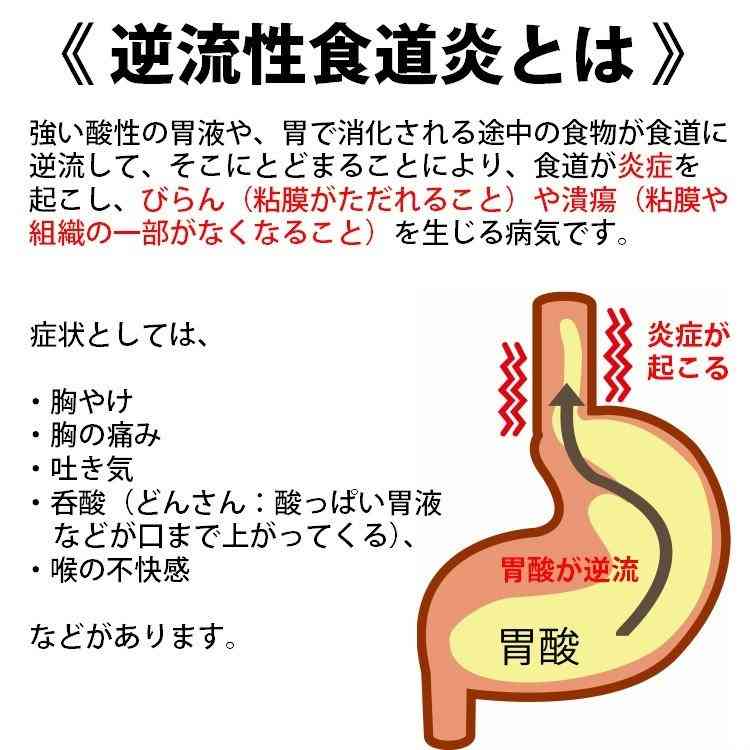 逆流性食道炎の人