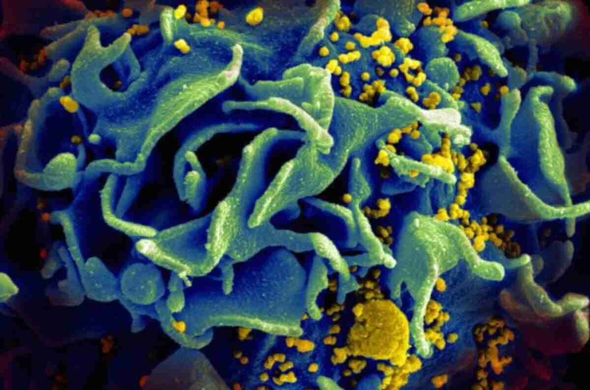 Discovery of new highly virulent and damaging HIV variant in the Netherlands