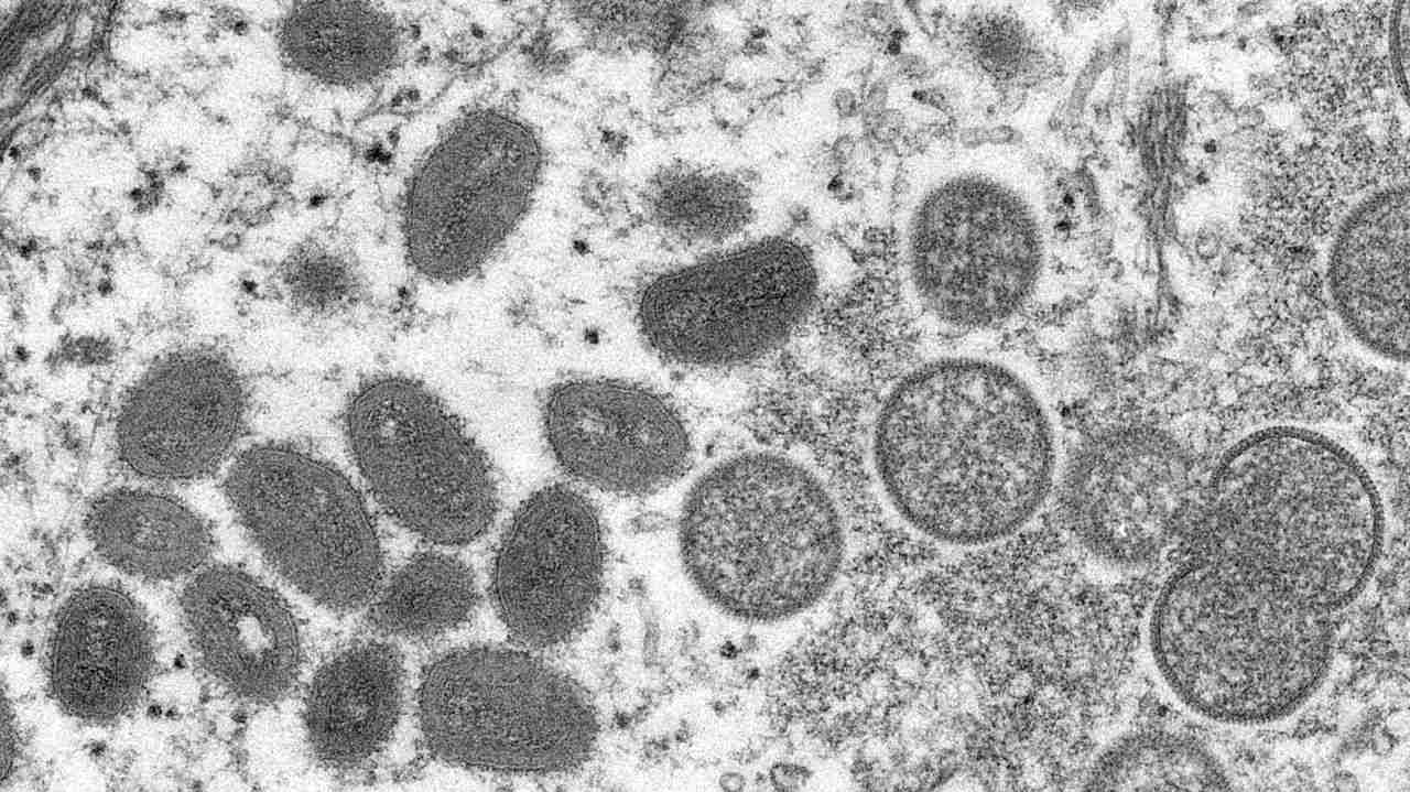 サル痘感染の男性が脱走 メキシコ - Yahoo!ニュース