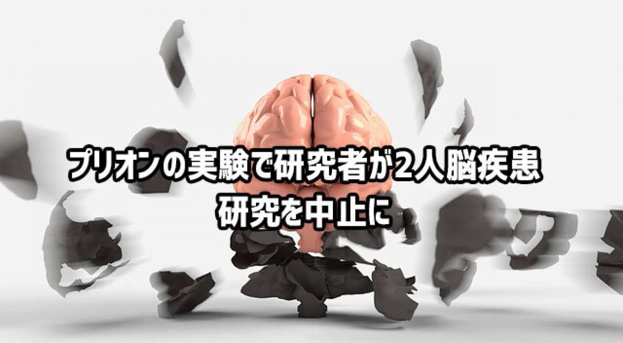 感染性因子「プリオン」を扱う研究所職員が2例目のヤコブ病発症。感染した疑いがあるとして研究を中止に（フランス） (2021年8月2日) - エキサイトニュース