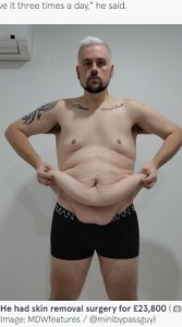 毎食マクドナルドを14年続けて体重216キロになった男性、死を覚悟し127キロ減量（豪）