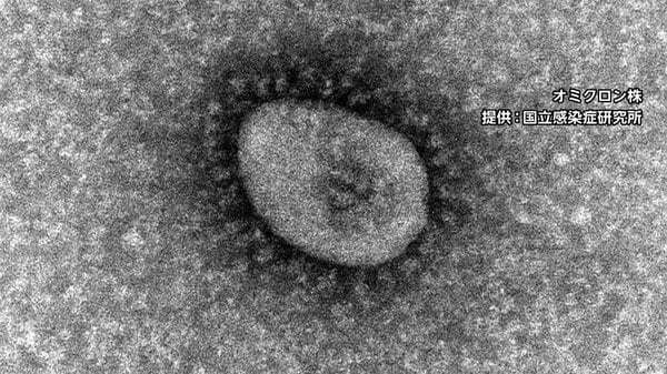 オミクロン株の後遺症「せきが最も多い」　味覚・嗅覚障害は大きく減少