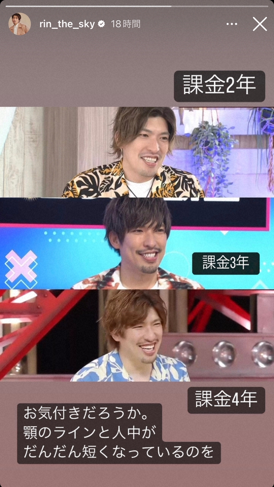 EXIT・りんたろー。　過去3年間の“課金顔”ビフォーアフター公開　美容医療で小顔に変化― スポニチ Sponichi Annex 芸能