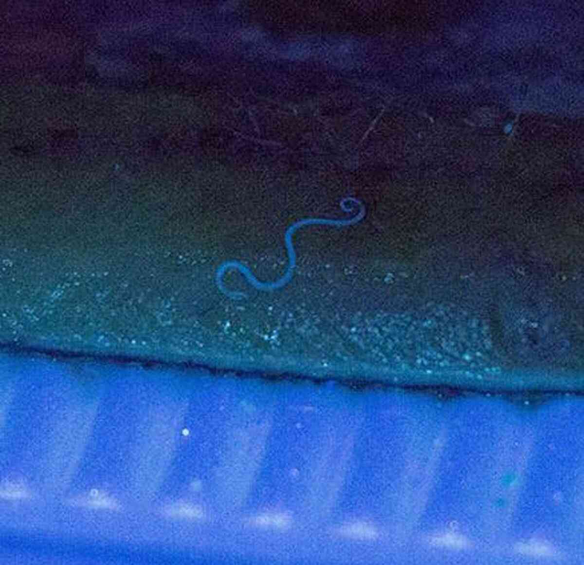 刺し身食べ腹痛、胃からアニサキス摘出　大津のスーパー鮮魚売り場を営業停止｜社会｜地域のニュース｜京都新聞