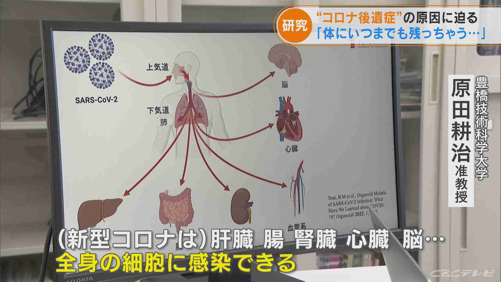 少量のウイルスが体内に残り続ける「持続感染」　新型コロナ後遺症について 新たな研究結果発表 | TBS NEWS DIG
