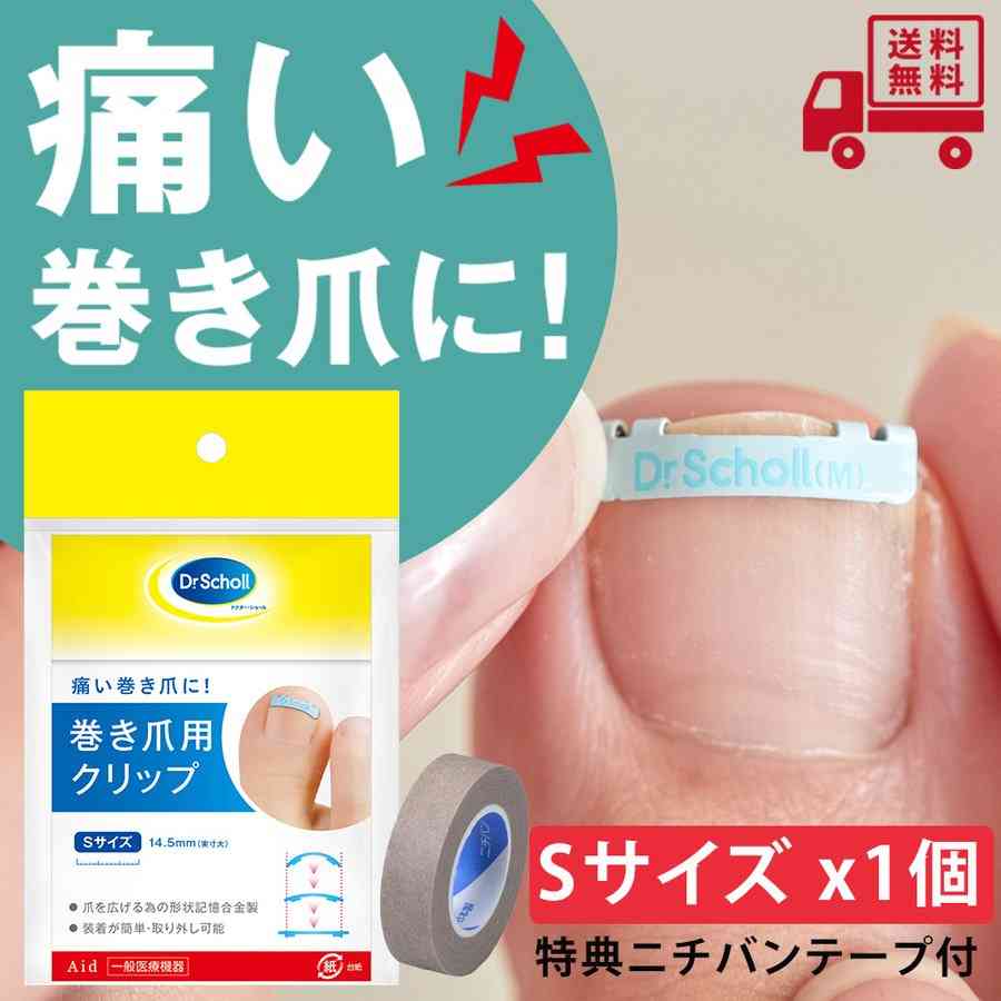 「足の爪の端の白い部分を切らないでください」「切って尖った部分が足の肉に刺さって…」巻き爪外来からのお知らせが話題