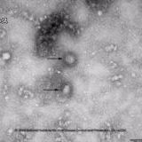 >>4519それ、ワクチンであるって実証出来ないやつだよね？小児の全身麻酔経験者の... | ガールズちゃんねる - Girls Channel -