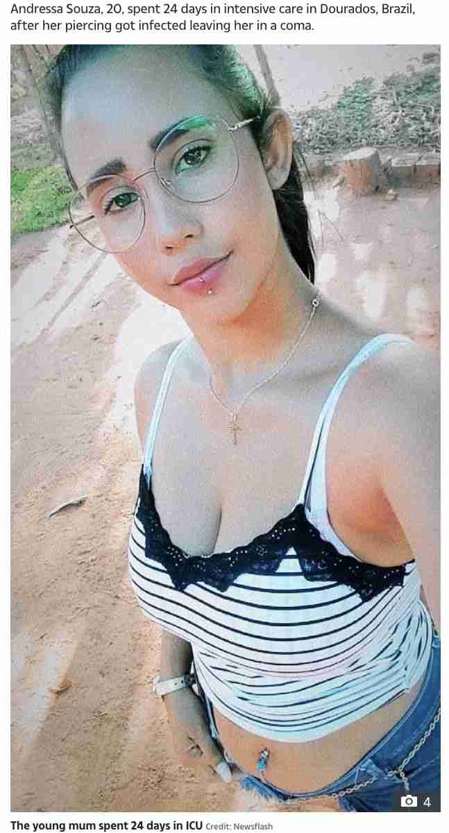 【海外発！Breaking News】唇のピアスが原因で感染症を患った20歳女性、敗血症により死亡（ブラジル） | Techinsight（テックインサイト）|海外セレブ、国内エンタメのオンリーワンをお届けするニュースサイト