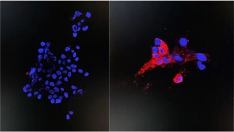 香港大学のチーム、オミクロン株の分離と培養に成功 | SciencePortal China