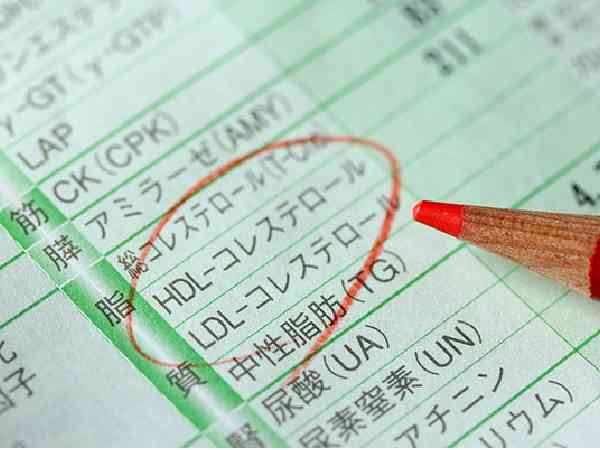 50代女性のコレステロール基準値超えが問題ない理由 | ハルメク美と健康