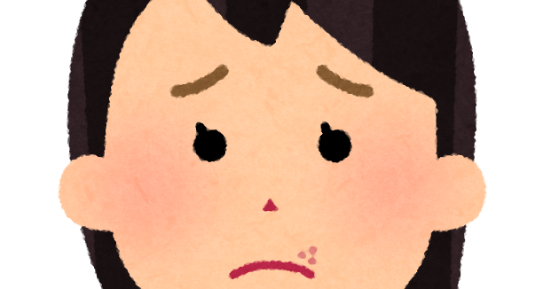 口唇ヘルペスのイラスト | かわいいフリー素材集 いらすとや