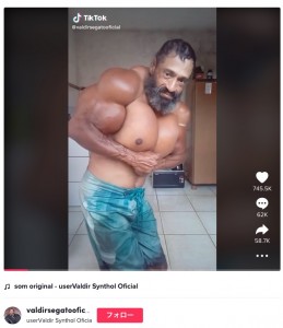 医者の忠告を無視し腕にオイルを注入　「ブラジルのハルク」と呼ばれた男性が死亡