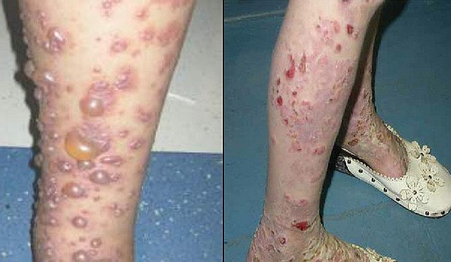 報告は氷山の一角！コロナワクチン接種後の副反応、死亡のツイートが多すぎて戦慄！vol.355 | 泣いて生まれてきたけれど