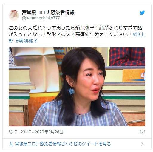 ヒアルロン酸注入した事ある方、検討中の方