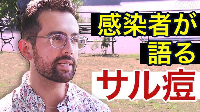 サル痘感染者「人生でいちばん、痛かった」 | NHK | サル痘
