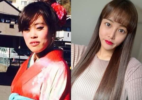 【整形美女】成人式で写真を撮られたくなかった…頭の先から足まで整形した女性がたどり着いた答え「結局は顔じゃない」