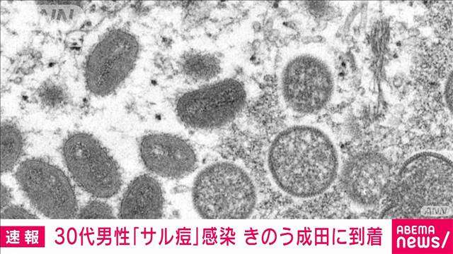 【速報】成田空港に到着の欧州在住30代男性がサル痘に感染　発疹が出て検疫所で申告（テレビ朝日系（ANN）） - Yahoo!ニュース