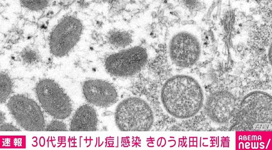 成田空港に到着した男性のサル痘陽性が判明 千葉県「空港で相談してくれたので早期に診断ができた」 | 国内 | ABEMA TIMES