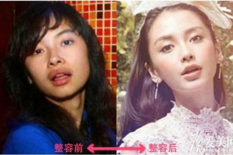 “離れ目の童顔になりたい”眼球の位置を変えようとした女性 “フル整形4周目”突入も「もうこれ以上はできないのがつらい」