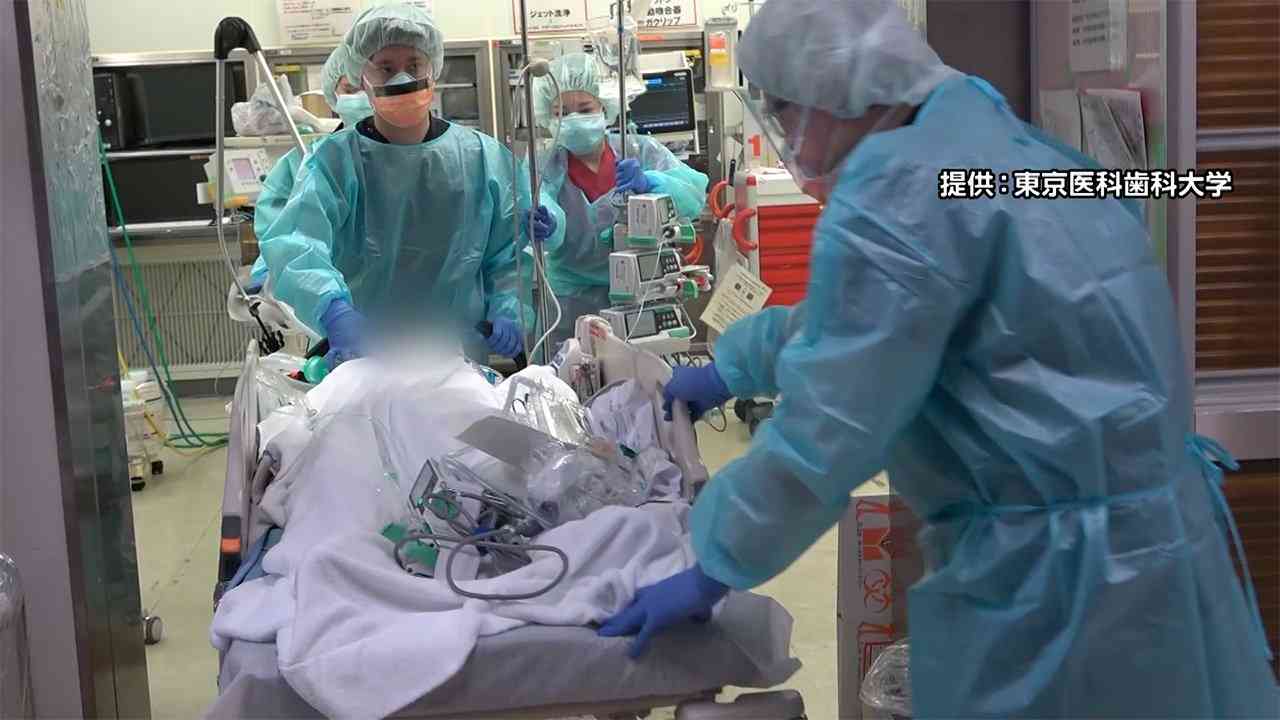 「重症化しにくい」に変化が　“第7波”直撃 コロナ医療現場の切実な“声”を聞け 「5類よりも、まずは感染者数を抑えて」（FNNプライムオンライン） - Yahoo!ニュース