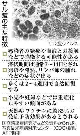サル痘、拡大の兆候なし 初確認1カ月、4例判明 専門家「過度な心配不要」