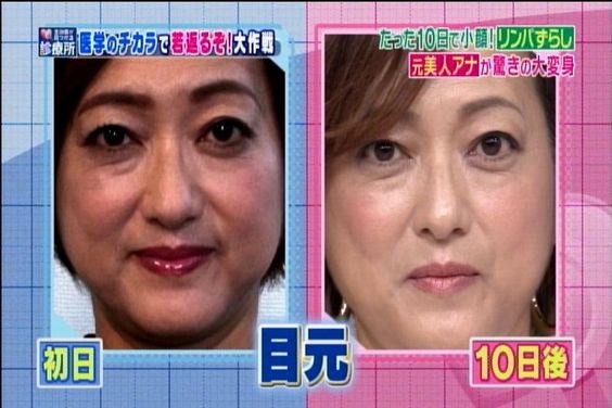 目が大きい人が羨ましい