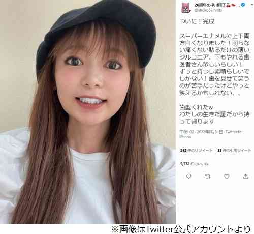 中川翔子が“真っ白の歯”披露「やっと笑えるかもしれない」
