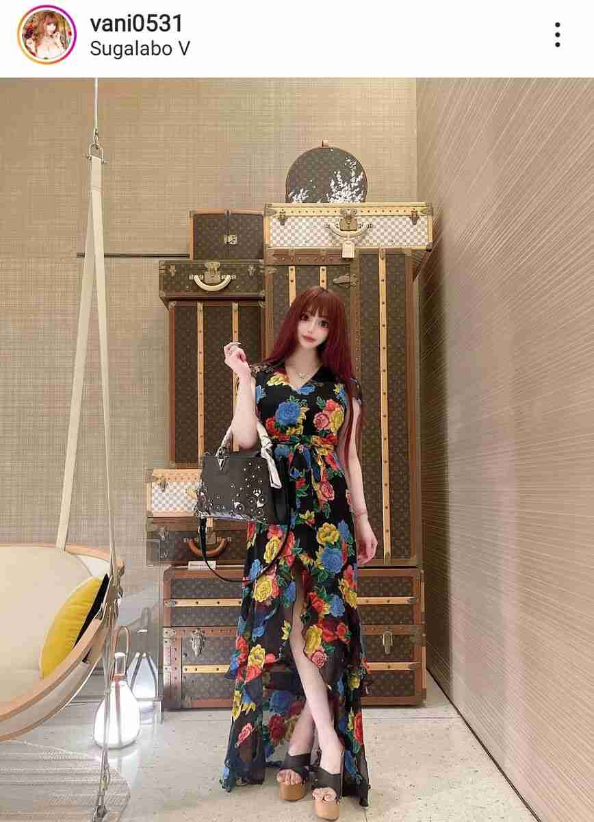“整形に３億円”話題のヴァニラ、ワンピース私服姿に反響「美しい」「スタイル良い」 : スポーツ報知