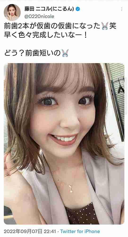 藤田ニコル　短い前歯の“仮歯の仮歯”姿披露に「自然！」「より大人っぽい」の声