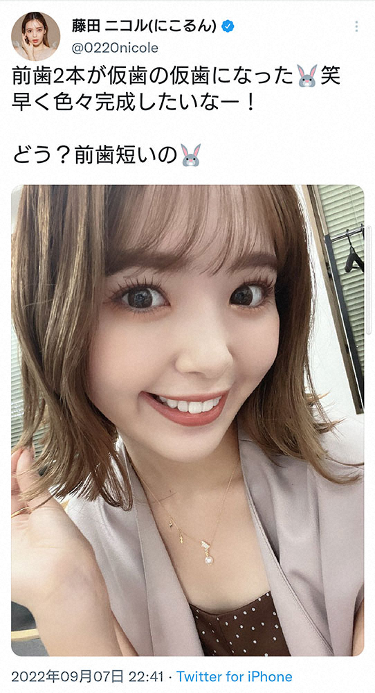 藤田ニコル　短い前歯の“仮歯の仮歯”姿披露に「自然！」「より大人っぽい」の声― スポニチ Sponichi Annex 芸能