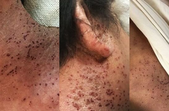 【コロナワクチン接種者は歩く生物兵器】 毒の排出で未接種者が被害を受けているvol.5 | 泣いて生まれてきたけれど