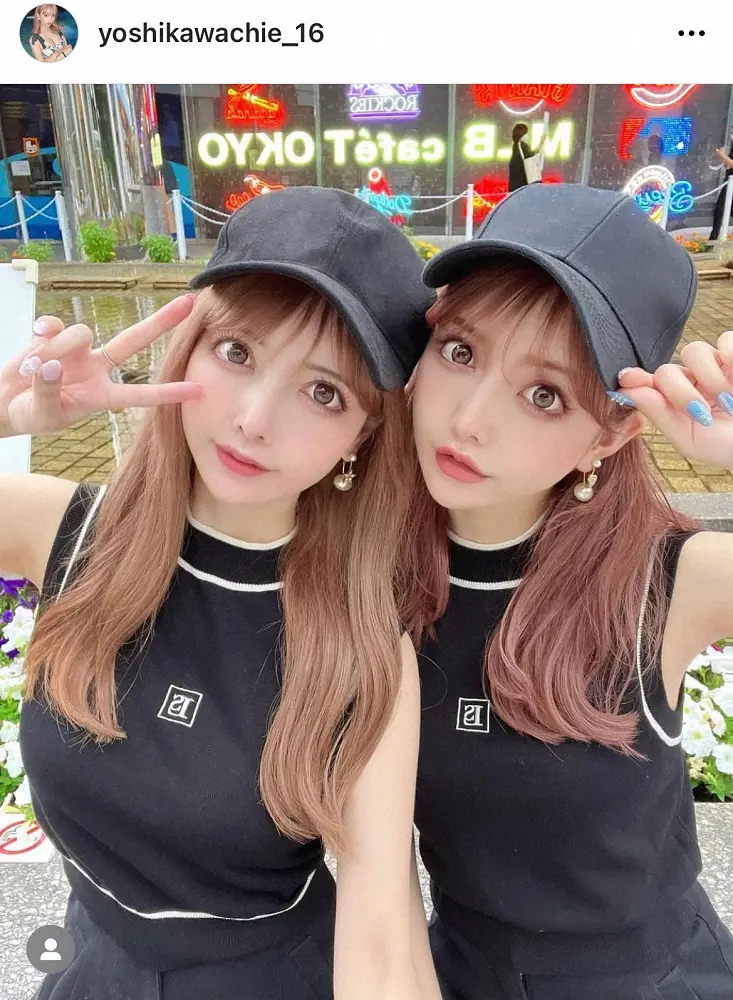 「乳輪をレーザーで焼いて皮膚を剥がした」「肋軟骨を取って鼻に移植」…総額4000万円!双子整形モデルが体験した“壮絶手術”
