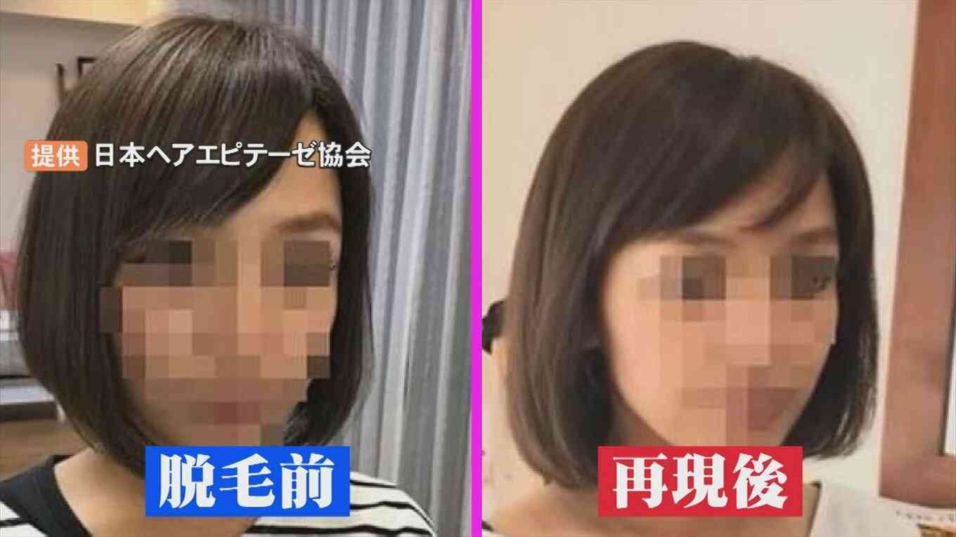 全国でわずか43人…「再現美容師」　がん治療の副作用に悩む人に寄り添い、髪形の「再現」に挑む